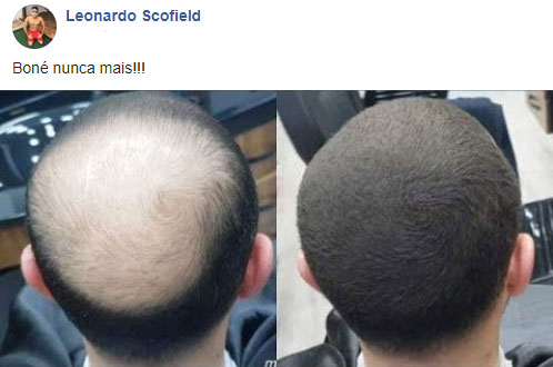 Hair Power