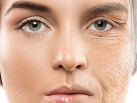 Lofty Skin